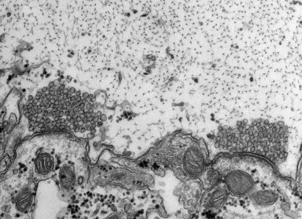 EM image of a sea lamprey synapse. Credit: Paul Oliphant, Morgan lab