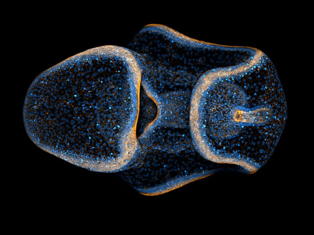 Bat star bipinnaria at fourth day of development Photographed using confocal microscopy. Histones are labeled in blue, actin filaments in orange. Credit: N. Carrigan via cc license