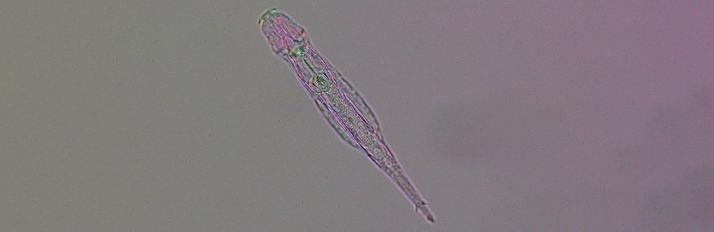 Bdelloid rotifer