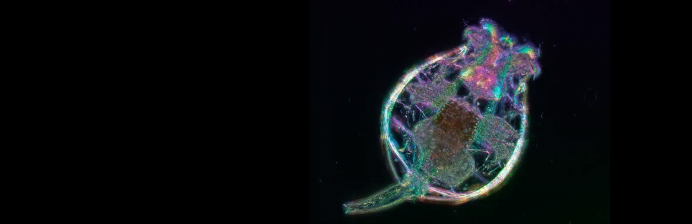 Rotifer. Credit: Kristin Gribble and Michael Shribak | Equipment: Polychromatic Polscope