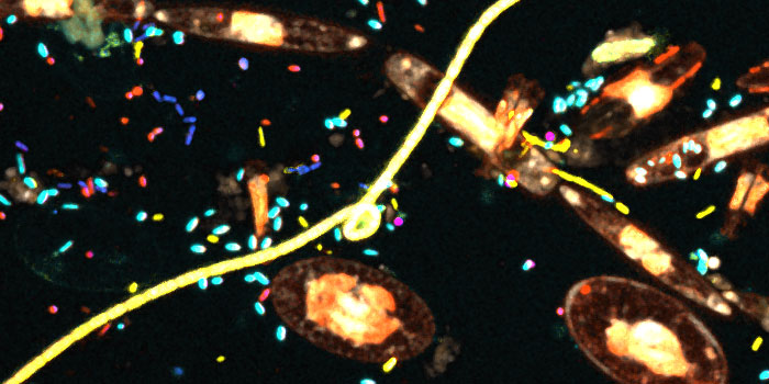 Microbes on marine microplastics Credit Cathleen Schlundt