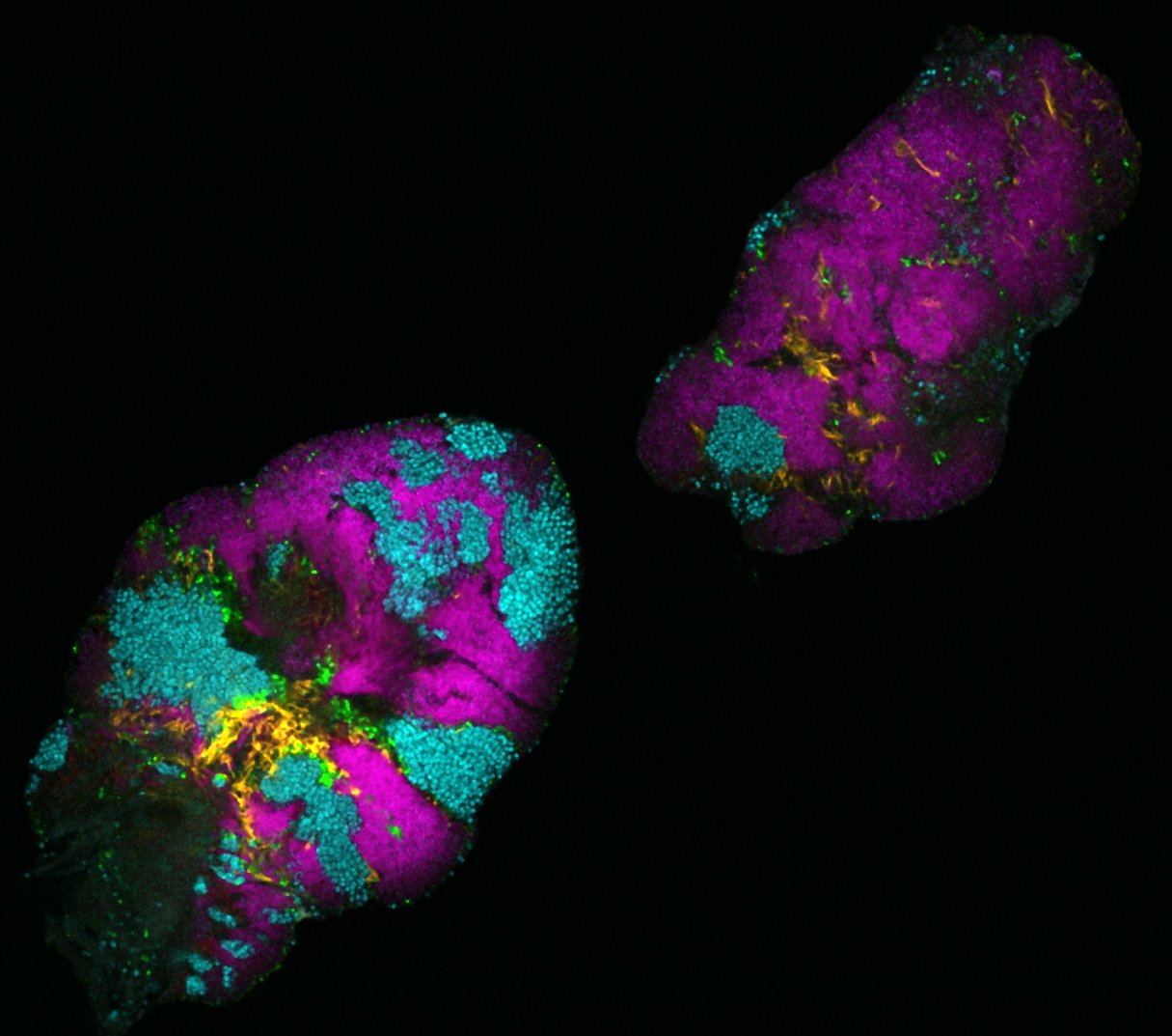 Bacterial biofilm from a human tongue