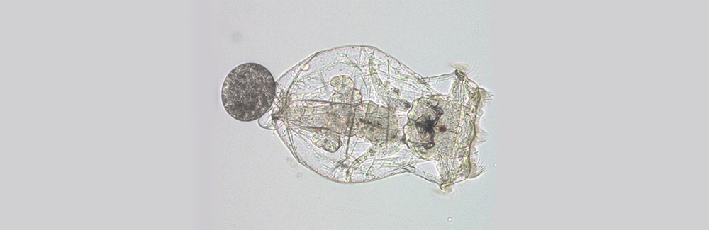 rotifer with egg