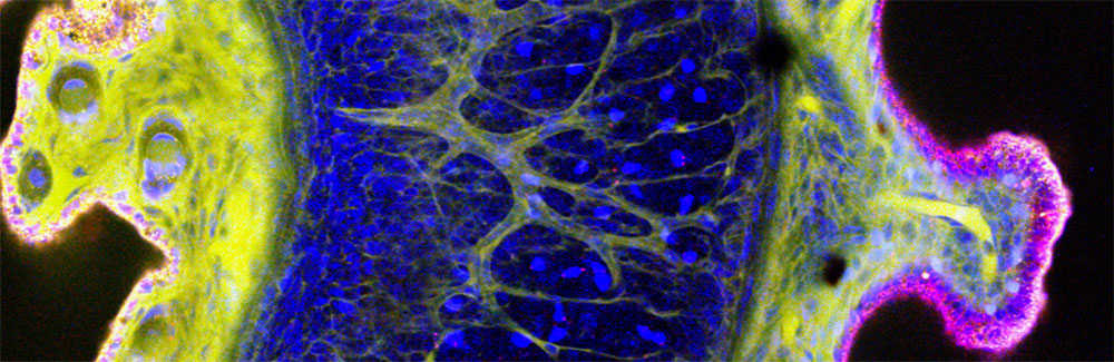 Confocal microsopy of octopus arm and suckers. Credit Stephen Senft, Hanlon Lab