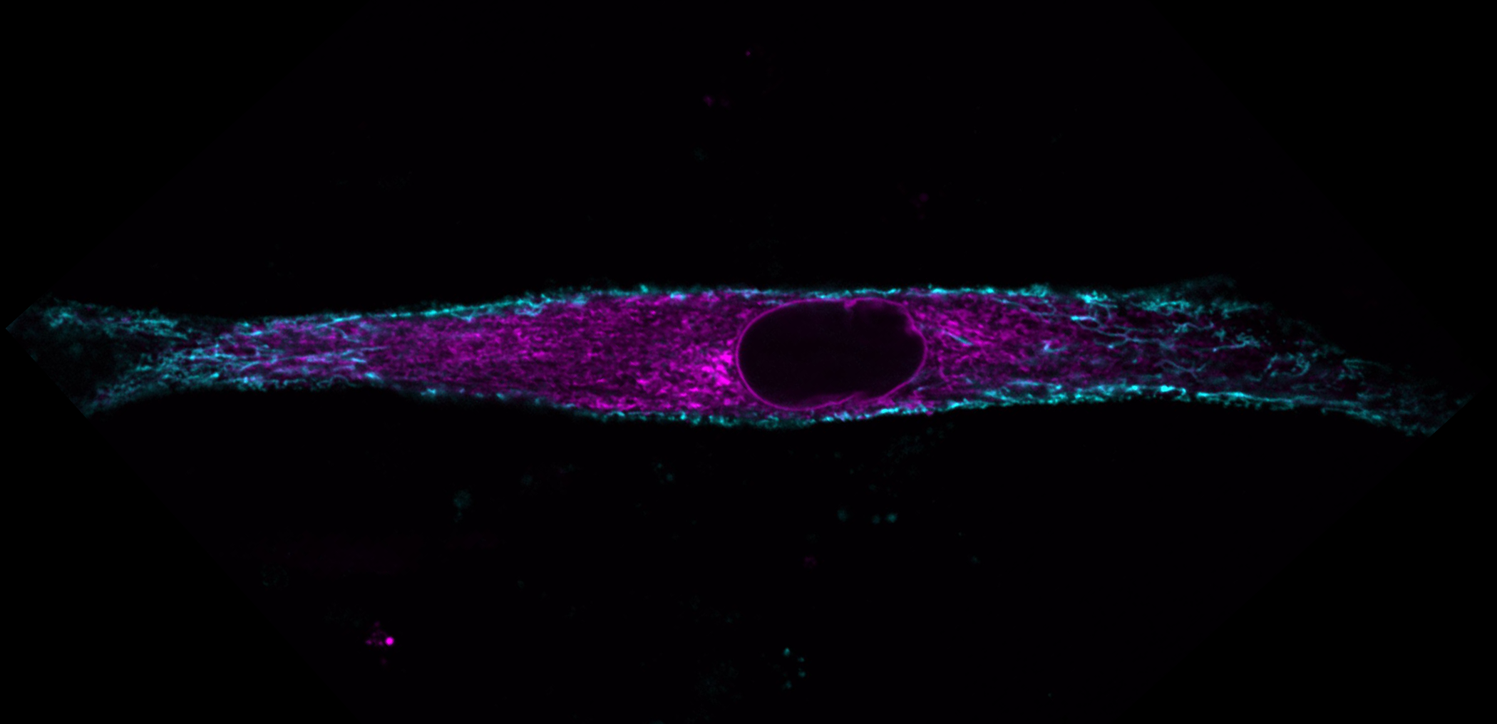 Myoblasts (muscle cells) from mice offer a window into the function of nuclear movement. Credit: Raquel Pereira (@Pereira_ARR)