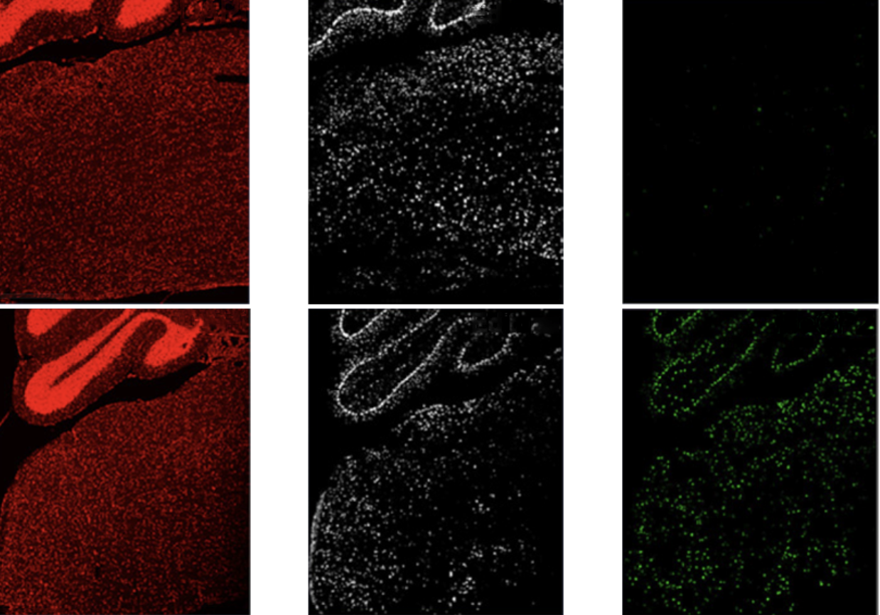 Rett Syndrome in mice brainstem