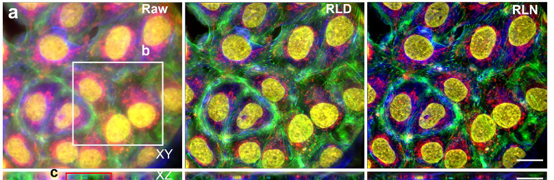 Images-of-human-cancer-cells-processed-with-Richardson-Lucy-Deconvolution---a-panel----and-a-neural-network-that-uses-RLD-Credit-Li-et-al-Nature-Methods-2022