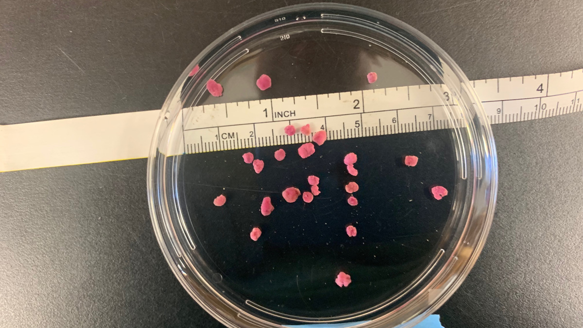 Pink berries in petri dish