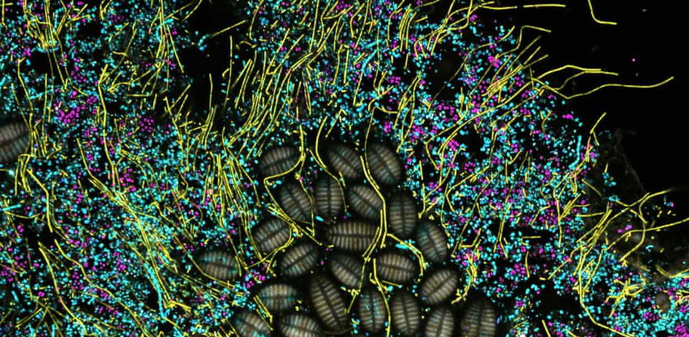Microbiy Shell A Call to Action: Preserve Microbes, Too | Marine Biological Laboratory