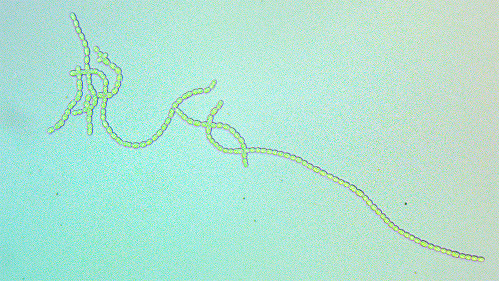 Filamentous cyanobacteria N punctiforme