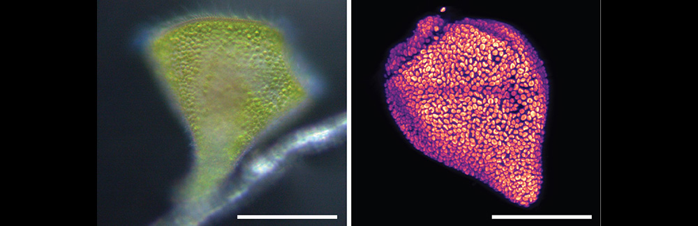 Stentor stipatus contains endosymbiotic algae, the green of which mixes with a dark pigment to give the species a reddish-brown color. Left: Dense cortical packing of algal cells in the S. stipatus cell. Right: Autofluorescence of the algae. Scale bar approx. 100 microns. 