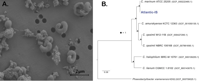 Images that Sharma captured at the MBL of the deep-sea microbe Cyclobacterium marinum led her lab to explore the “whys” of its unusual, deeply coiled shape. From Sharma and Lee, Microbiol. Resource Announc., 2019.