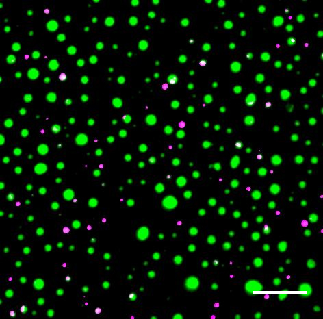 Distinct protein droplets form with different RNA. Scale bar is 10 um. Credit: EM Langdon et al, Science, 2018