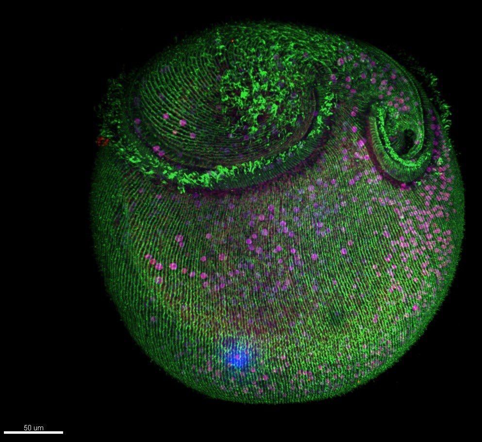 Microtubule structures in Stentor. Credit: Victoria Yan, MBL Physiology course