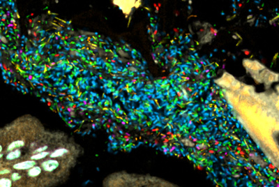 Bacteria in a model human gut microbiome established in a germ-free mouse. Each bacterial species is lit up with a different colored probe, creating a map of the community's spatial organization. Credit: Jessica Mark Welch and Yuko Hasegawa, MBL