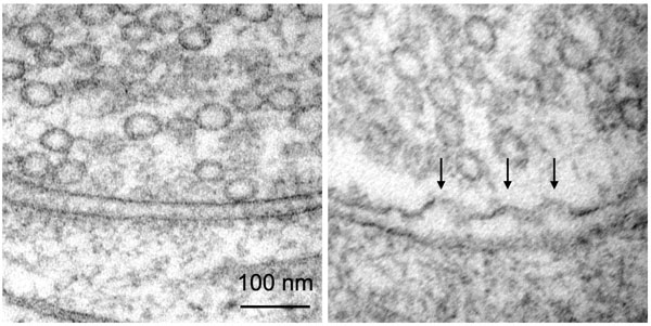 600-synapses-before-and-after-stimulaton-with-arrows-showing-the-moment-of-synaptic-vesicle-fusion-credit-mbl-neurobiology-course-2016
