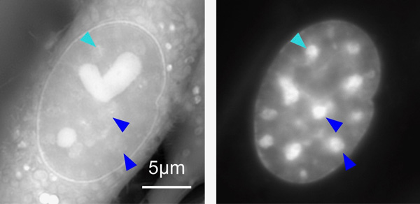 Left) OI-DIC image of a live mouse cell visualizing “density” of materials. The bright regions with the heart- and sphere-shapes are special compartments in the cell called “nucleoli". (Right) a conventional fluorescence microscopy image of the same cell depicting only DNA. The bright regions are the “heterochromatin”. Some heterochromatin are marked with arrow heads for comparison between the two images. Note that they look different because the fluorescence image (Right) does not necessarily show density of the materials.