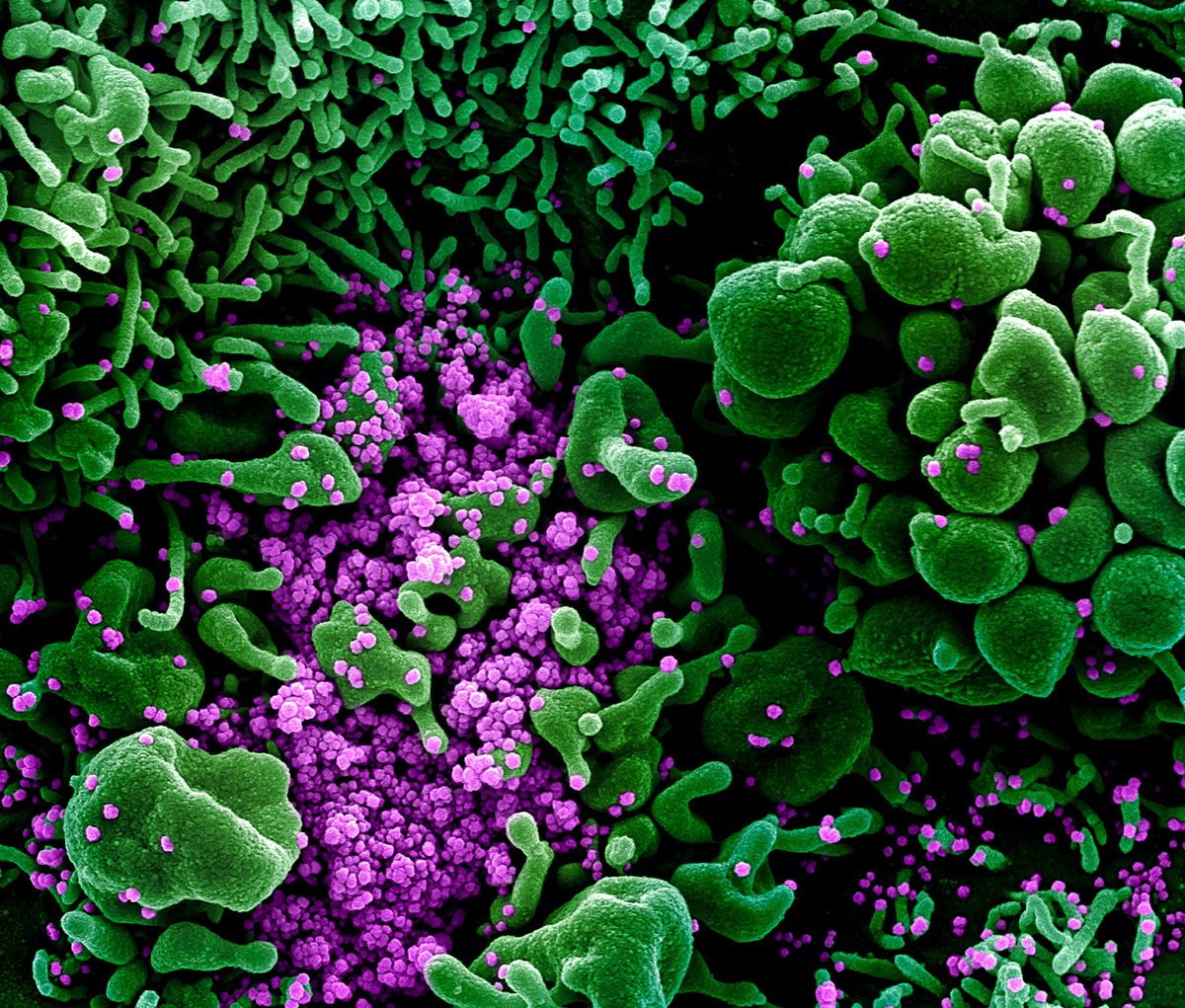 A cell (green) heavily infected with COVID-19 virus particles (purple), isolated from a patient sample. The cell is undergoing programmed cell death. Colorized SEM image. Credit: National Institute of Allergy and Infectious Diseases, NIH
