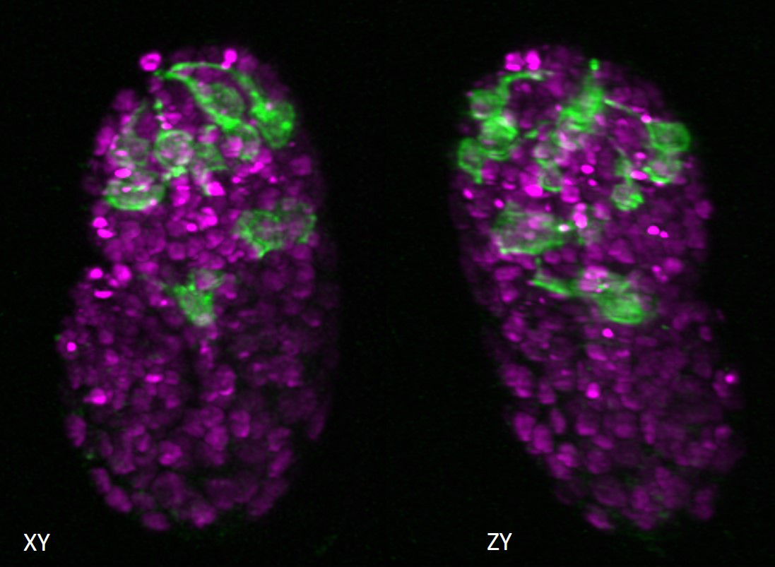 Lateral and axial images of C. elegans embryo expressing neuronal (green) and pan-nuclear (magenta) markers. Isotropic resolution enables lineage tracing and inspection of neurite outgrowth pre-twitching. Credit: L. Duncan and M. Moyle