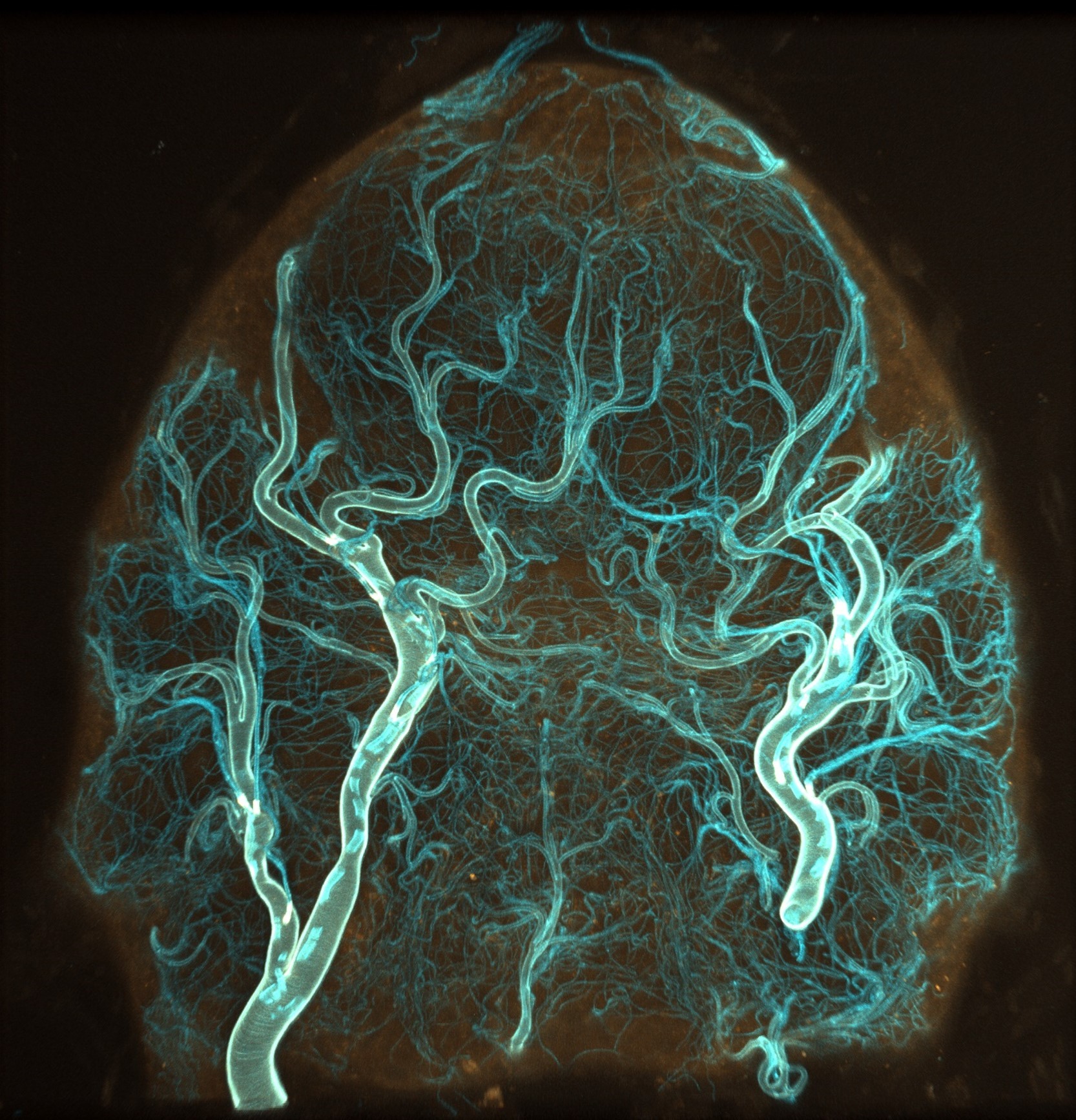 The "brain" of an adult male dog tick (Dermacentor variabilis). Trachael structure (blue) surrounding neuronal tissue (orange). Imaged on ZEISS LSM 900 confocal microscope . Credit: Carola Städele.