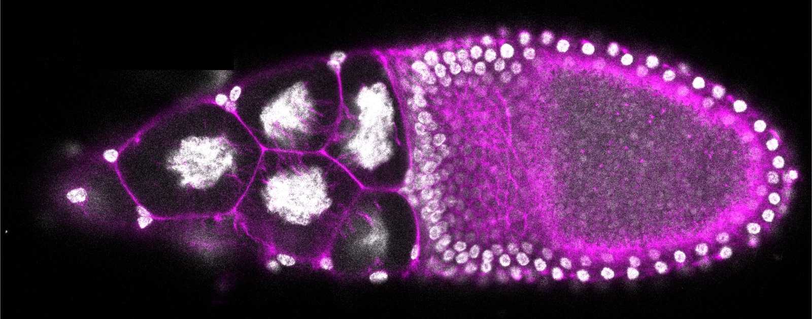 Fruit Fly (Drosophila) egg chamber. Actin filaments in magenta and nucleus/DNA in grey. Taken during #Embryo21 on ZEISS microscope. Credit: Viraj Doddihal, Graduate Student at the Stowers Institute for Medical Research, under direction of Sally Horne-Badovinac