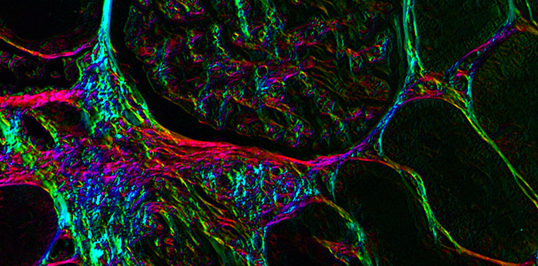 Glomerular capillaries in kidney tissue imaged with the polychromatic polarization microscope developed at MBL
