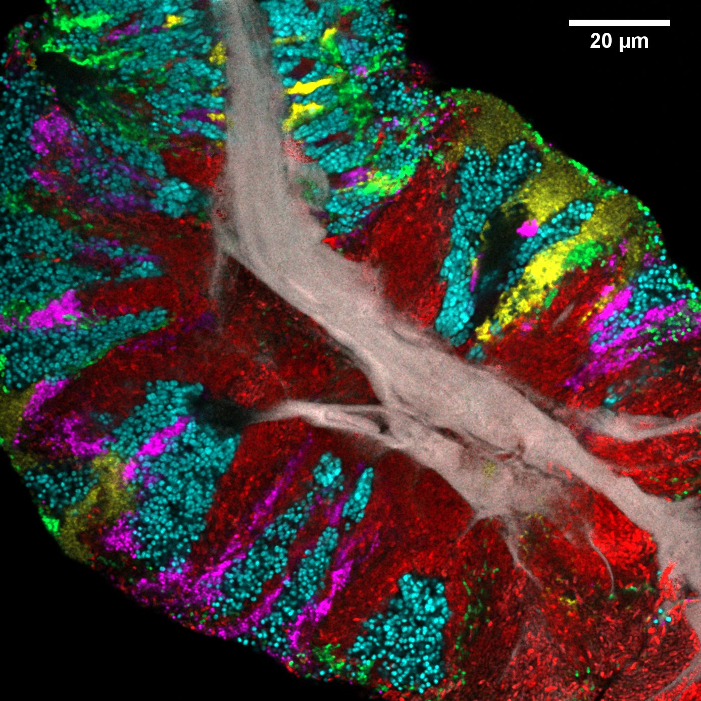 Bacterial biofilm scraped from the surface of the tongue and imaged using CLASI-FISH. Human epithelial tissue forms a central core (gray). Colors indicate different bacteria: Actinomyces (red) occupy a region close to the core; Streptococcus (green) is localized in an exterior crust and in stripes in the interior. Other taxa (Rothia, cyan; Neisseria, yellow; Veillonella, magenta) are present in clusters and stripes that suggest growth of the community outward from the central core. Credit: Steven Wilbert and Gary Borisy, The Forsyth Institute