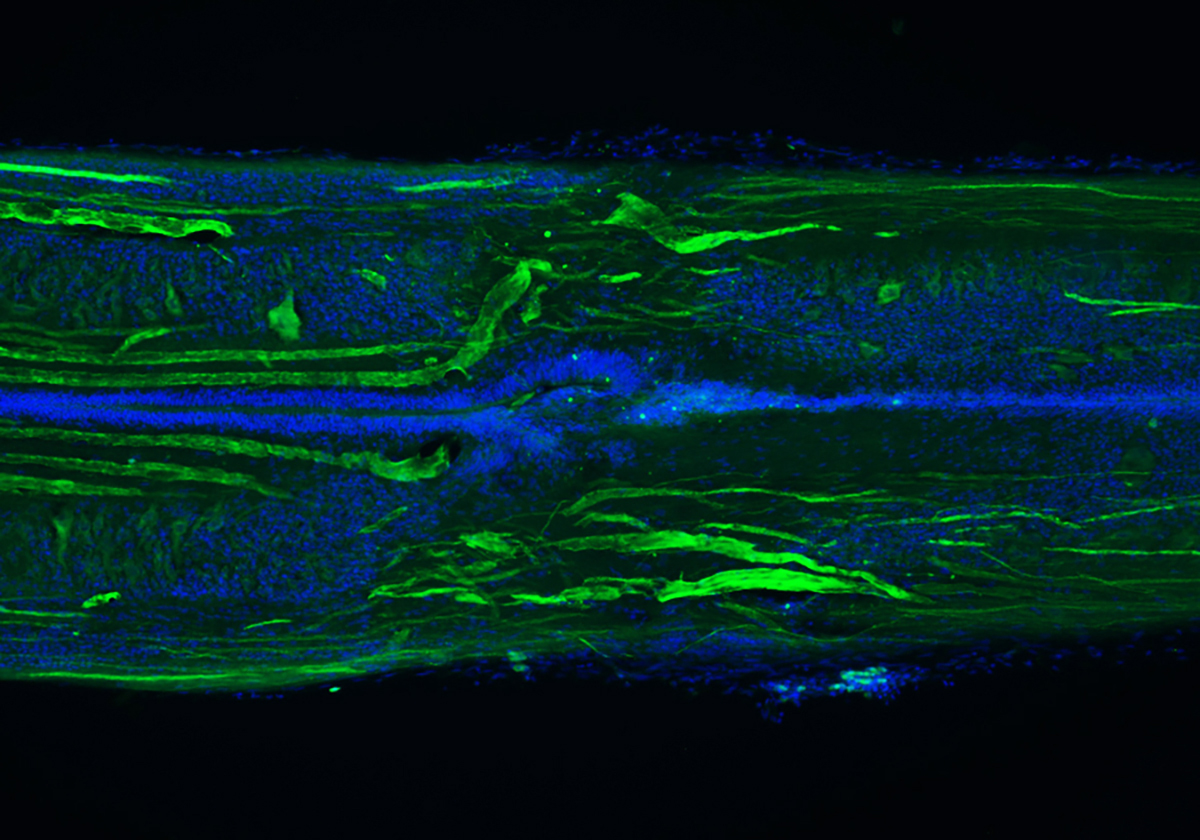 morgan-jennifer-regeneratedspinalcord2-1