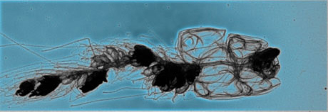 The colonial, jellyfish-like species Nanomia bijuga. The colony’s propulsive unit or nectosome (the transparent segment at right) tows its reproduction and feeding units over distances that can reach 200 meters a day. The oval structure at the tip of the nectosome is the pneumatophore, which serves as a float. Credit: John H. Costello