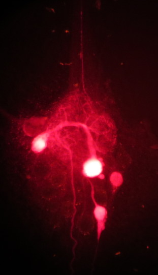Crab stomatogastric ganglion (STG) with tracer-filled cells. Credit: Neural Systems and Behavior faculty, 2015.