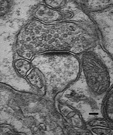 Synapse on dendritic spine (EM)