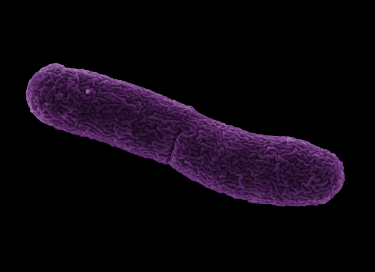The Wolbachia bacterium (colorized purple). Credit: Dennis Kunkel, Sarah Bordenstein and Robert Brucker