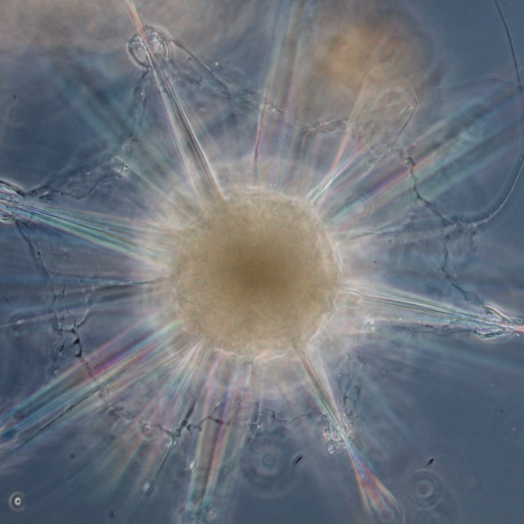 Astrolithium, a marine microbe taken from a sedimented sample of seawater near Woods Hole, Mass. Credit: David Patterson, Linda Amaral Zettler, Mike Peglar and Tom Nerad (micro*scope).