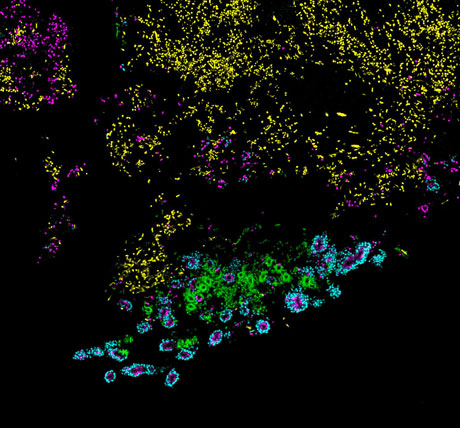 Bacteria from the human mouth. Credit: Jessica Mark Welch