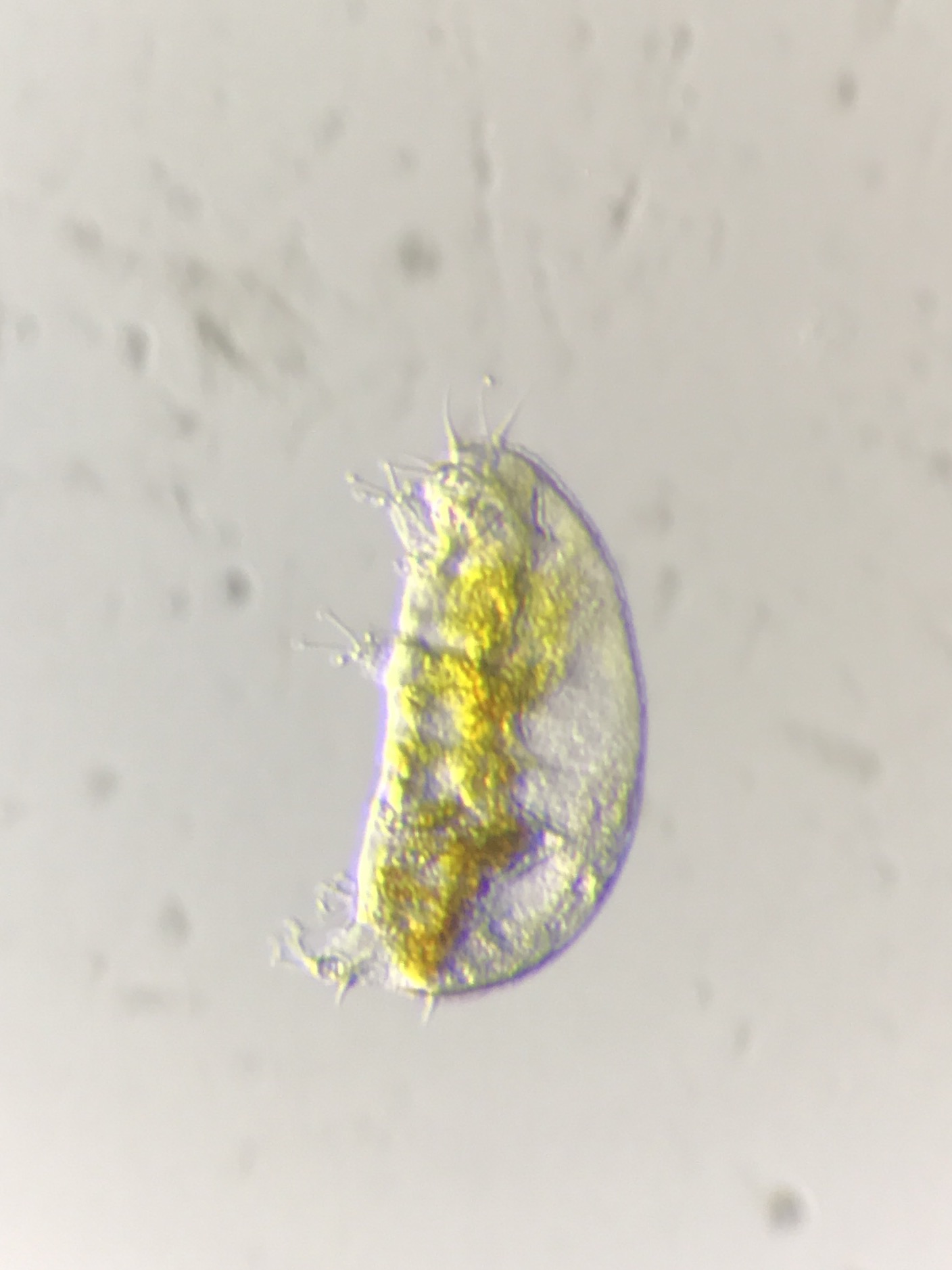 Light microscopy image of a marine tardigrade Thomas Boothby found at Stony Beach in Woods Hole, Mass