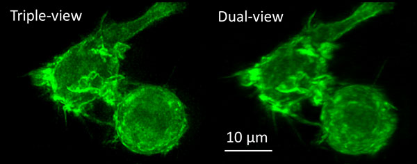 Macrophage actin labeled with green fluorescent protein, imaged with the new triple-view microscope (left) and the original dual-view microscope (the diSPIM, right). Credit: Yicong Wu and Valentin Jaumouille