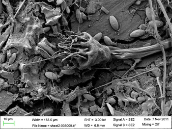 Suctorian ciliate covered with symbiotic bacteria, along with diatoms, and filaments on weathered and cracked microplastic debris. Credit: Erik Zettler, Sea Education Association