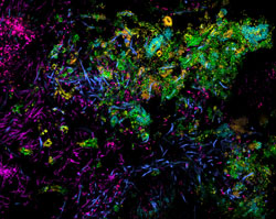 A detail image of “corncobs” at the edge of a hedgehog structure. Each dot or rod is a bacterial cell. Photo credit: Jessica Mark Welch, MBL, and Blair Rossetti, Forsyth Institute.