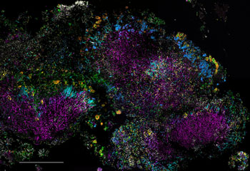 An imaging technology developed at MBL allows visualization of microbial community structure. This is a mixed population of microbes in human dental plaque. Credit: Jessica Mark Welch, MBL