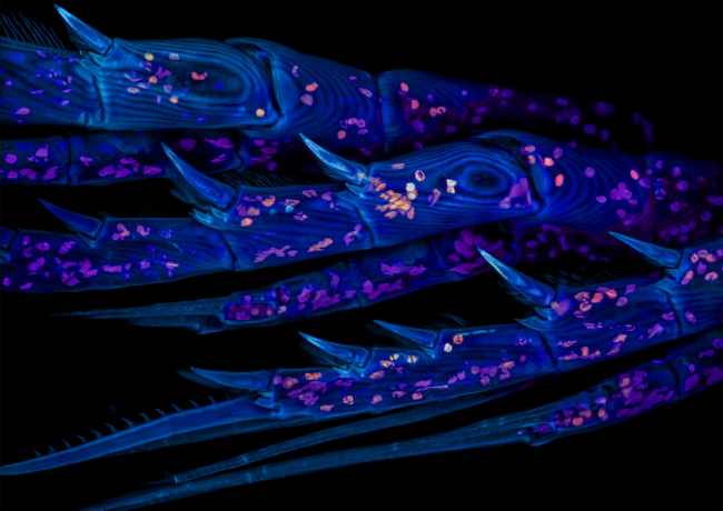 A marine copepods legs imaged under a microscope