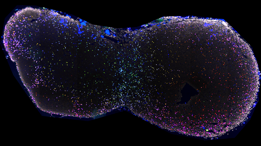 Mouse cervical lymph node stained for nuclei (DAPI, white), IL17+ cells (red), IFN+ (green), and T cells (CD3, blue). Image taken on Zeiss LSM 780 with supervision from teaching assistants Sarah Christensen, Isaak Tarampoulous, and Tiffany Lu. 