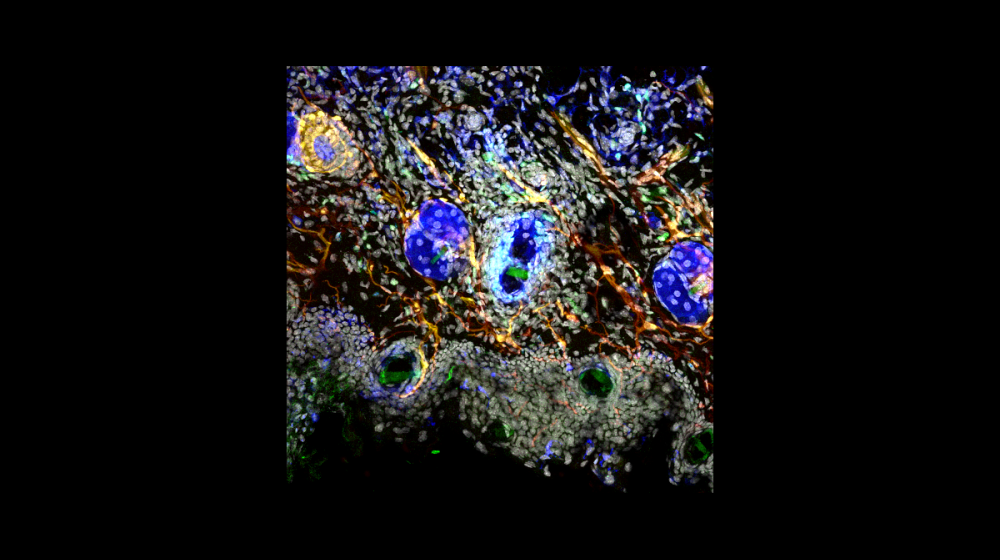 Mouse ear skin stained for nuclei (DAPI, white), Schwann cells (Plp1, red), CCR6+ B and T cells (green), and T cells (CD3, blue). Image taken on Leica Stellaris 8 with supervision from teaching assistants Sarah Christensen, Isaak Tarampoulous, and Tiffany Lu. 
