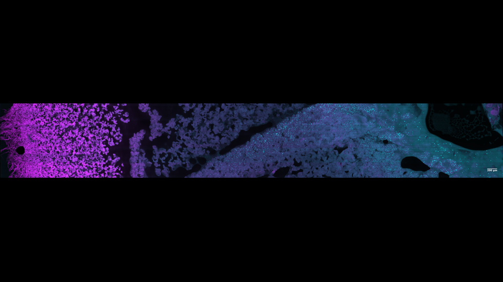 Bacillus subtilis colony biofilm with labeled Ypet (magenta) and antibiotic protein Subtilosin-A (cyan). Image taken on dual view line-scanning confocal with supervision from Matthew Parent.