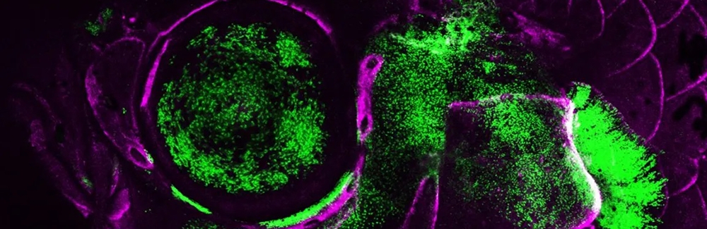 A live adult zebrafish showing showing Pou3f3 gene activity (green) in the gill cover, jaw support skeleton, and eye. Bone-forming cells are labeled in magenta. (Image by Peter Fabian/USC Stem Cell)