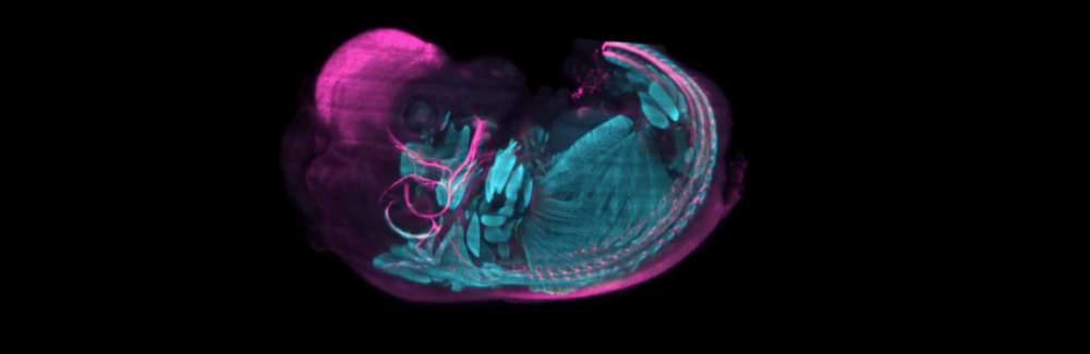 Imaging a Mouse Embryo | Marine Biological Laboratory
