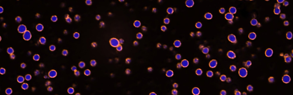 condensates - paraspeckles