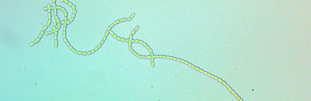 Filamentous cyanobacteria N punctiforme