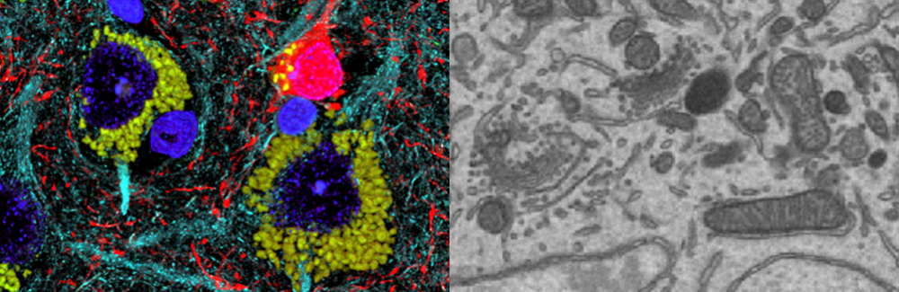 On left, immunofluorescence array tomography; on right PFIB-SEM.