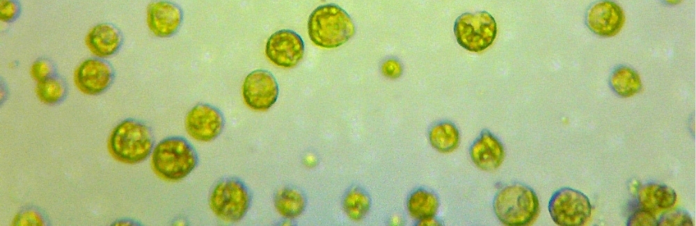 Algae under a microscope 
