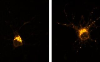 neurons treated with nicotine
